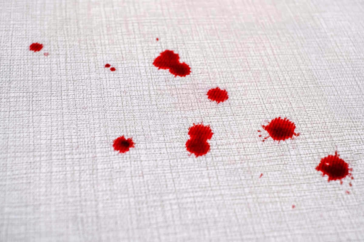 Rimuovere le macchie di sangue: tecniche efficaci per pulire ogni tessuto con facilità